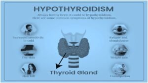 thyroiditis 