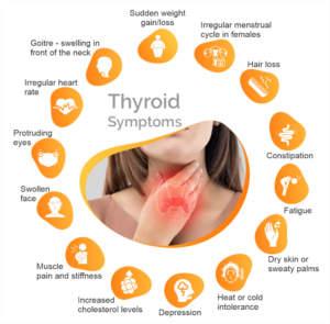 thyroiditis 