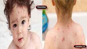 5 common diseases affecting children under 10 years of age 