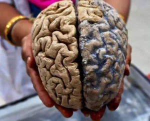 ऑर्गन ट्रांसप्लांट"