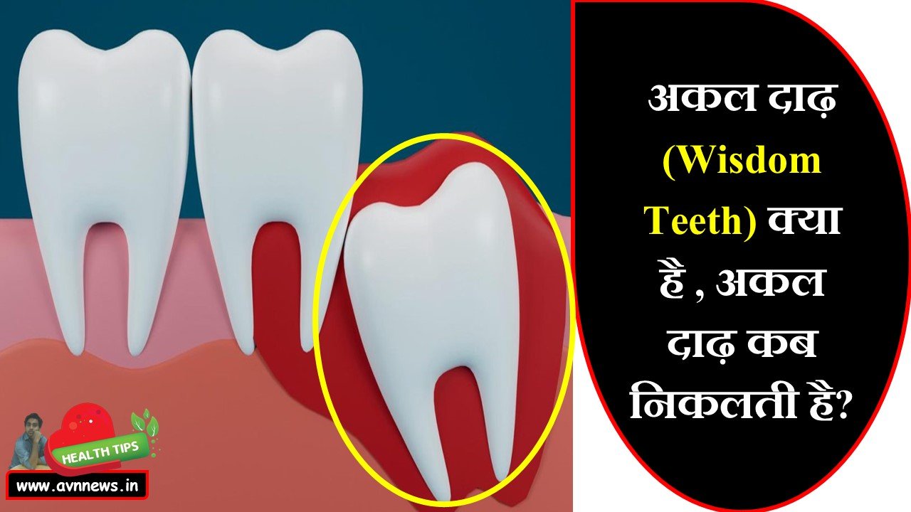अकल दाढ़