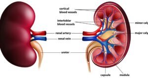 किडनी खराब
