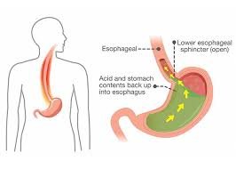  किडनी खराब