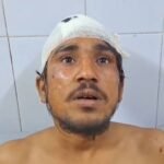 जमुई में जड़ी-बूटी बेचने वाले दो भाइयों की बेरहमी से पिटाई