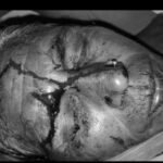 जमुई के गिद्धौर में खेत की मेड़विवाद को लेकर महिला पर हमला, तीन लोगों पर मारपीट का आरोप